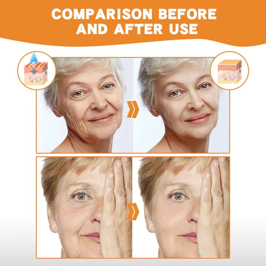 2025 New Instant Skin Essence Collagen Setgen Set