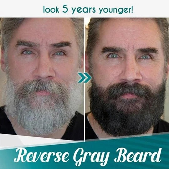 (💥New Year Sale💥- 40% OFF) Waterproof Beard Filling Pen Kit